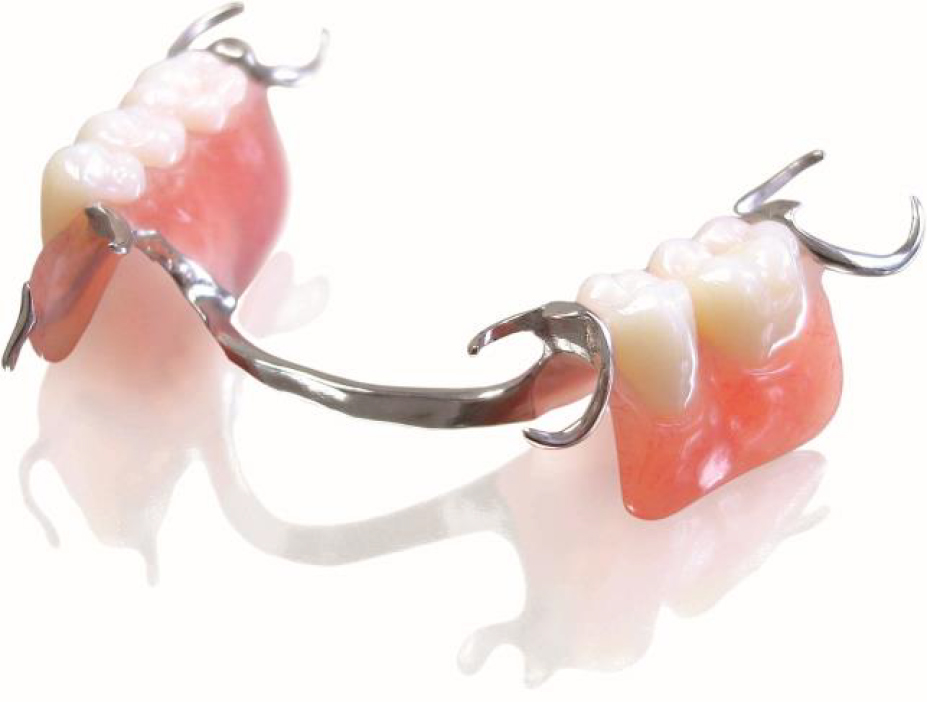 A partial denture at CustomFit Denture Clinic